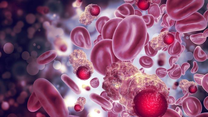 Các tế bào ung thư máu xen lẫn với hồng cầu - Ảnh minh họa từ HEALTH LINE