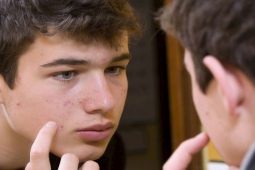 Đàn ông - 4 nguyên tắc giúp chàng “thổi bay” mụn trên da