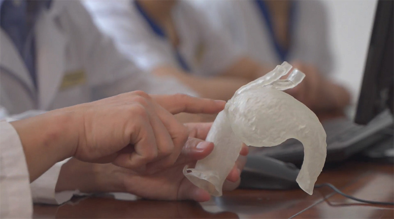 Vinmec áp dụng công nghệ 3D hỗ trợ can thiệp tim mạch lần đầu tiên ở Đông Nam Á - 3