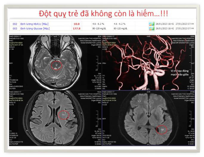 Cảnh báo với bệnh cứ 5 người thì 1 mắc - 1