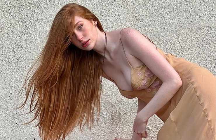 Một cô gái cũng có mái tóc đỏ, mắt xanh và làn da trắng với nhiều tàn nhang khác là Madeline Ford (sinh năm 1996, Mỹ).
