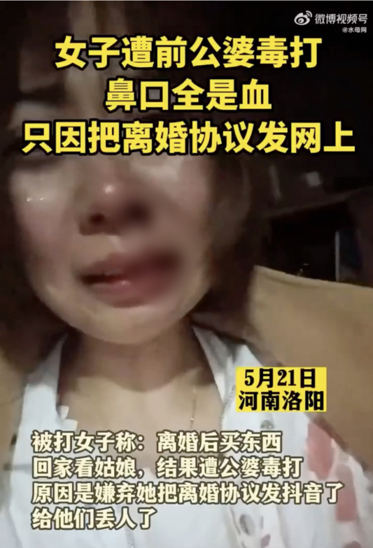 Người phụ nữ cho biết mình đã bị đánh khi đến nhà chồng cũ để thăm con gái. Ảnh: Weibo