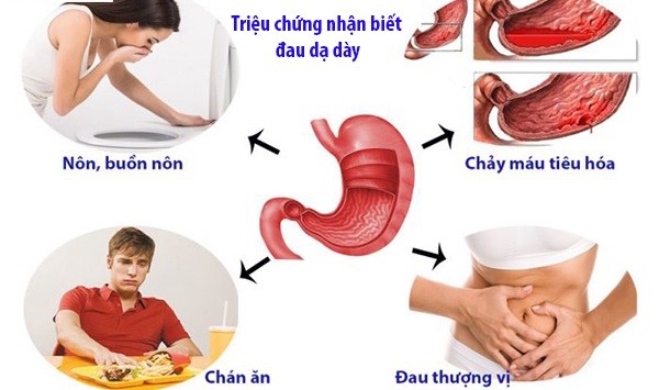 Làm sao để tránh xa chứng đau dạ dày mãn tính? - 1