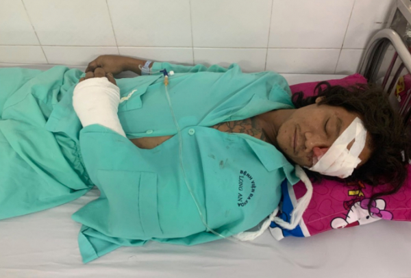 Một nạn nhân ở Long An nhập viện vì chó pitbull cắn.