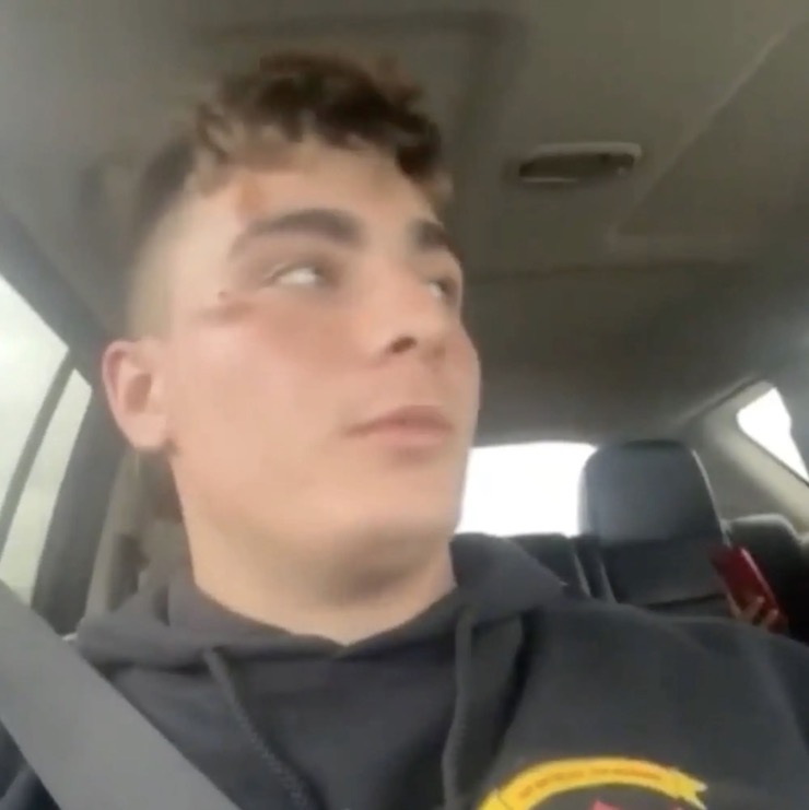 Hunter Antonino, một trong 3 binh sĩ Mỹ bị hành hung kể lại sự việc.