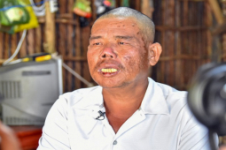 Tin tức trong ngày - Một ngư dân sống sót kỳ diệu sau gần 4 ngày bơi giữa đại dương