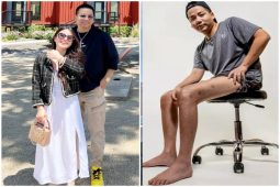 Giải trí - Khoa Pug đáp trả thâm thuý khi bị hỏi "kéo chân 5 tỷ có đi như người bình thường"