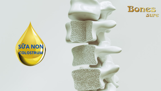 Bones Sure - Bí mật công thức sữa non xương khớp thế hệ mới - 1
