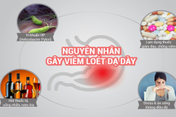 Sức khỏe đời sống - Viêm loét dạ dày, hành tá tràng: Dấu hiệu nào cần đi khám ngay?