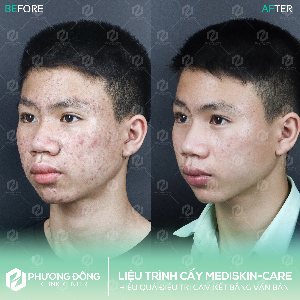 Phòng khám da liễu Phương Đông – Điều trị da chuẩn y khoa - 3