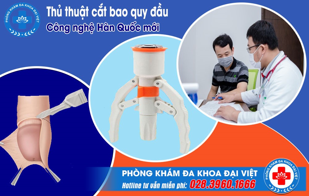 Cắt bao quy đầu - công nghệ mới Hàn Quốc - 1