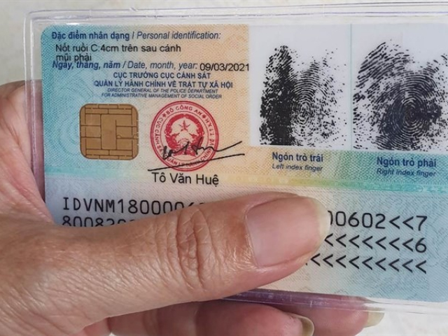 Tin tức trong ngày - Sau khi phẫu thuật thẩm mỹ bắt buộc phải làm lại căn cước công dân?