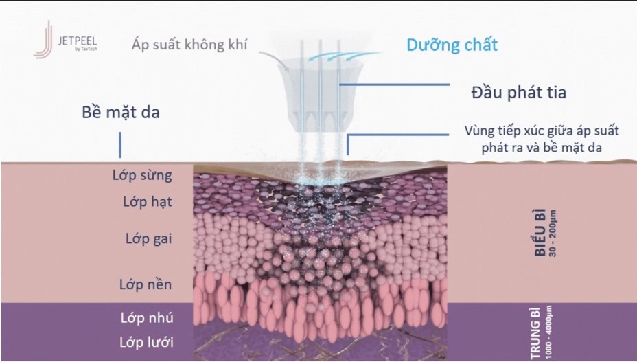 JetPeel® by TavTech – Tiên phong xu hướng làm đẹp bằng công nghệ không xâm lấn 2023 - 1