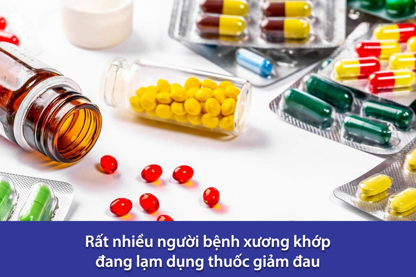 4 sai lầm “chí mạng” khiến bệnh khớp chữa mãi không khỏi - 1