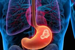 Sức khỏe đời sống - Cơ thể bất ngờ xuất hiện 20 dấu hiệu bất thường này, rất có thể là ung thư