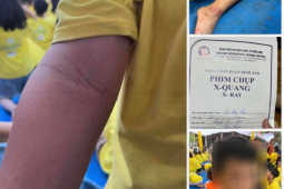 Sau vụ “trải nghiệm” khóa tu ở chùa Cự Đà: Lời khuyên từ chuyên gia giáo dục