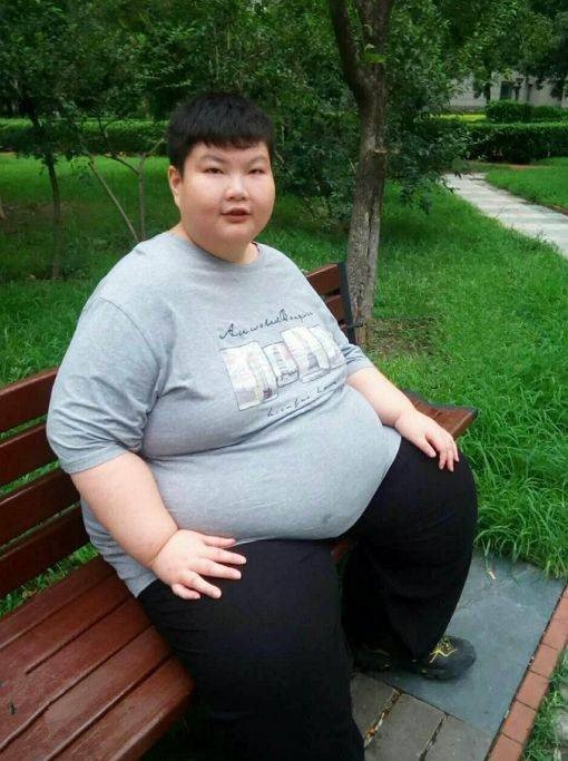 Cậu bé Từ Châu Lôi 14 tuổi đã nặng tới 180kg.