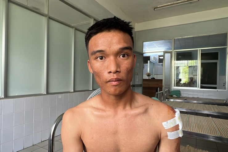 Cầu thủ Nguyễn Phi Hùng kể thời điểm xe gặp nạn. Ảnh: TN