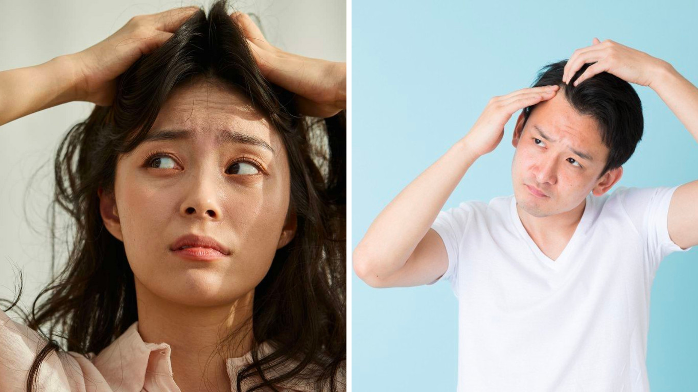 Gàu ngứa, bong tróc vảy xuất hiện ở nhiều đối tượng kể cả nam và nữ khi vào mùa nóng