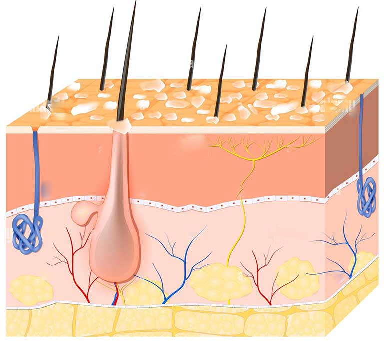 Nguyên nhân chính gây ra gàu được xác định là do sự tăng sinh quá mức của tế bào da đầu