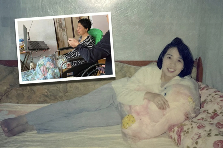 Người phụ nữ xinh đẹp bỗng chốc gặp bệnh nặng phải ngồi một chỗ. Ảnh: SCMP