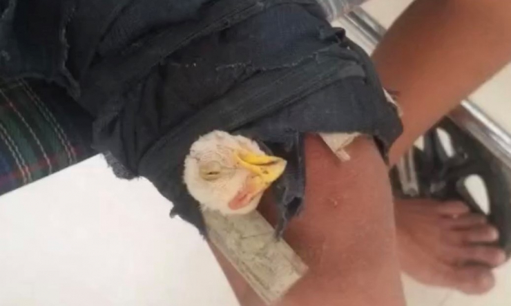 Con gà được bó vào vị trí gãy xương. Ảnh: TS