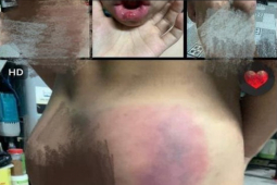 Tin tức trong ngày - Cô giáo dạy thêm bị tố đánh học sinh chảy máu miệng, sưng đầu