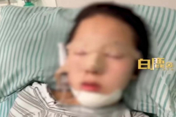 Bạn trẻ - Cuộc sống - Con gái nghiện game, mẹ đưa đi thẩm mỹ để cai nghiện