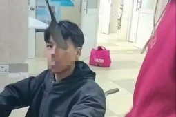 Tin tức trong ngày - Biểu diễn múa dao, thiếu niên bị dao cắm vào hốc mắt