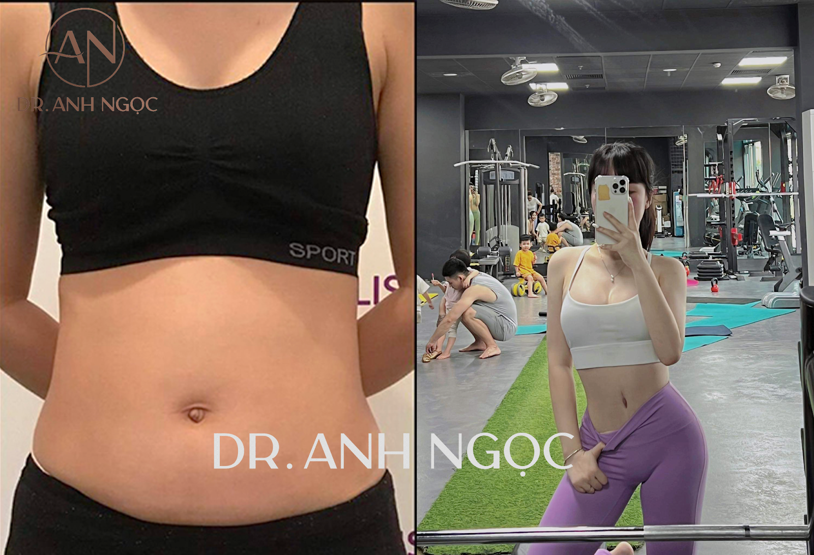 Bác sĩ Nguyễn Anh Ngọc chia sẻ phương pháp “thế hệ mới” lấy lại vòng eo thon gọn - 3