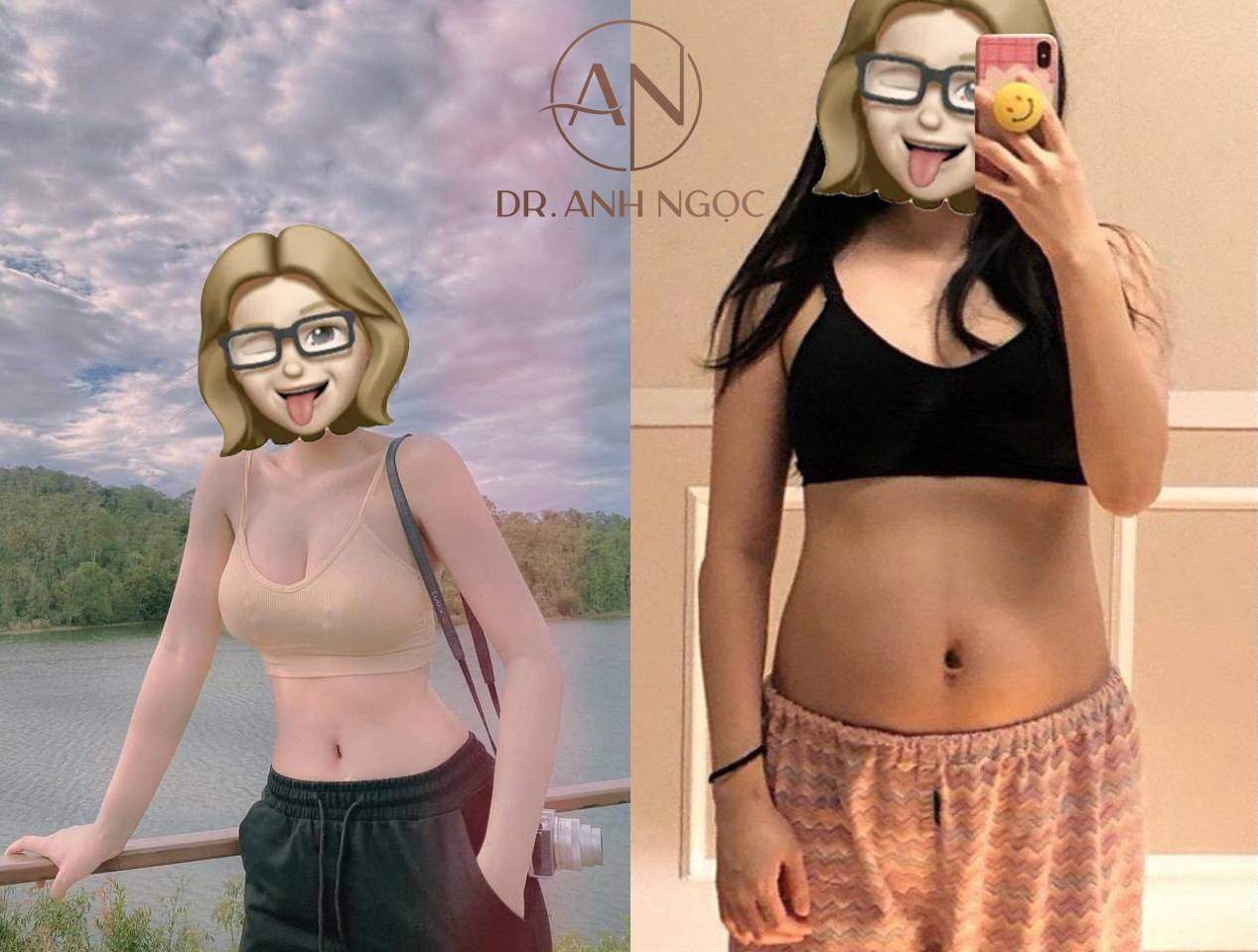 Mang lại vòng 2 thon gọn lý tưởng