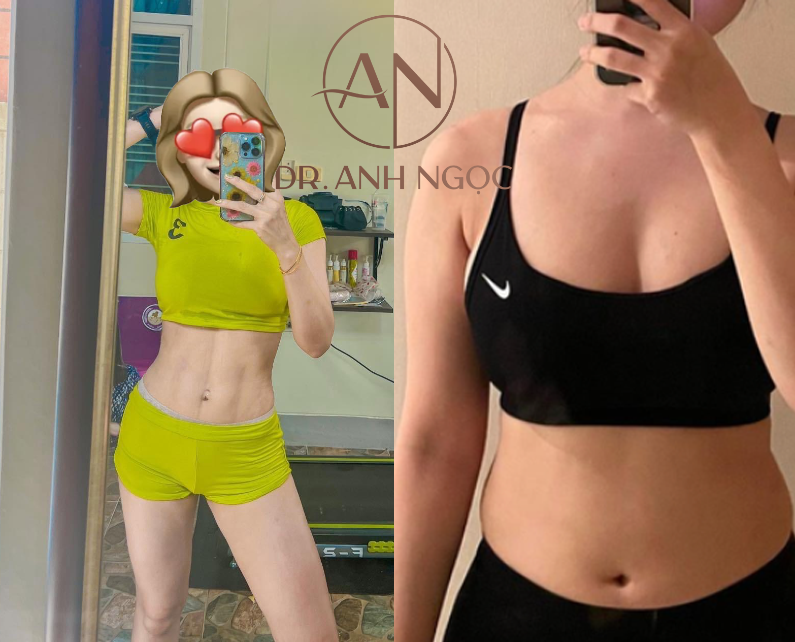 Bác sĩ Nguyễn Anh Ngọc chia sẻ phương pháp “thế hệ mới” lấy lại vòng eo thon gọn - 5