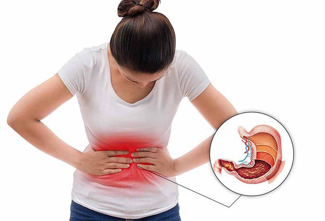 Những thói quen sai lầm có thể khiến dạ dày của bạn bị ăn mòn, viêm loét, gây đau đớn - 1