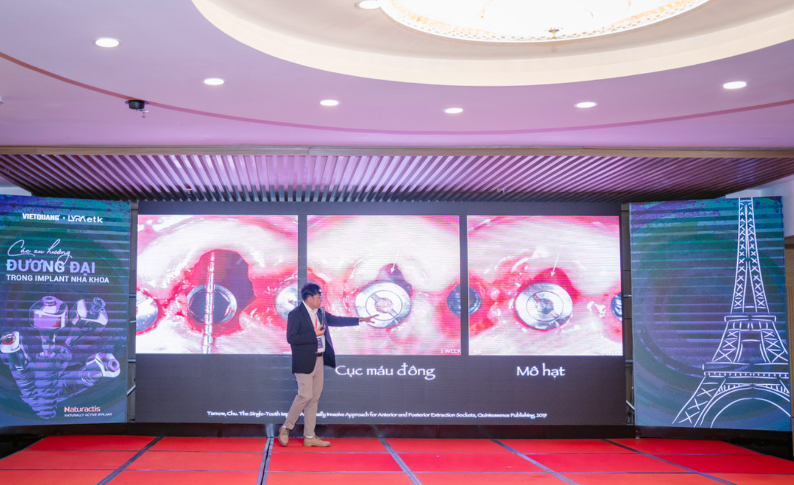 Buổi chia sẻ khoa học trong điều trị nha khoa