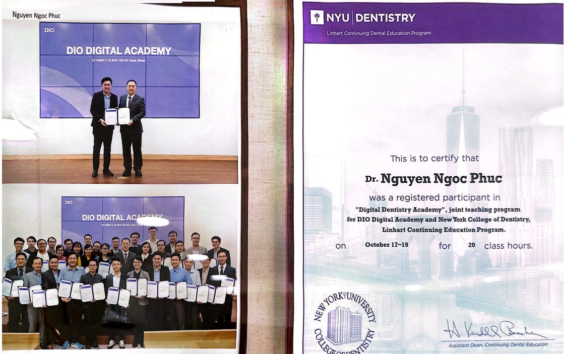 Giải pháp tối ưu cho người mất răng lâu - 5