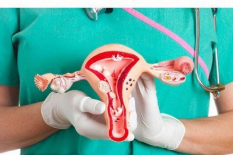 Phụ nữ nên biết 7 nguyên nhân gây ung thư buồng trứng