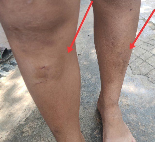 Một trong 5 cháu nhỏ bị 2 mẹ con bà T. đánh