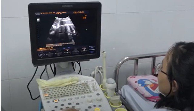 Sở Y tế Quảng Nam lên tiếng vụ bệnh nhân bị u buồng trứng phải, mổ bên trái- Ảnh 1.