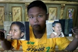 Sức khỏe đời sống - Cậu bé từng hút 40 điếu thuốc một ngày giờ ra sao?