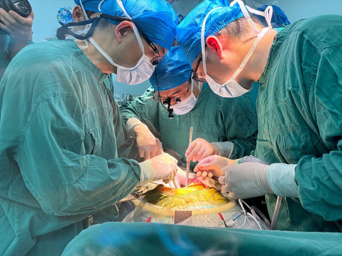 Các bác sĩ đang ghép gan lợn cho bệnh nhân 71 tuổi tại Bệnh viện Liên kết Số một, ngày 17/5. Ảnh: First Affiliated Hospital of Anhui Medical University