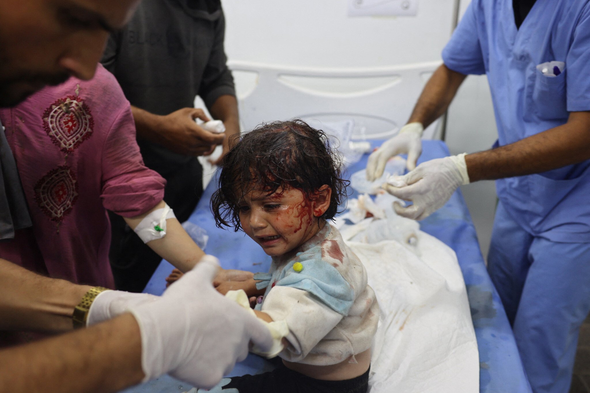 Trẻ em Palestine bị thương sau cuộc không kích gây phẫn nộ của Israel nhằm vào khu trại tị nạn ở thành phố Rafah, Dải Gaza.