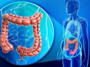 Sức khỏe đời sống - Dấu hiệu ban đầu dễ nhận biết nhất cảnh báo ung thư đại trực tràng