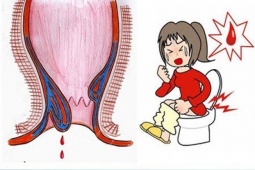 Bạn có để ý những điều này khi đi đại tiện?