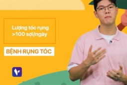 Việt Nam vui khỏe: Tình trạng tóc bạc sớm và gãy rụng nhiều ở người trẻ hiện nay