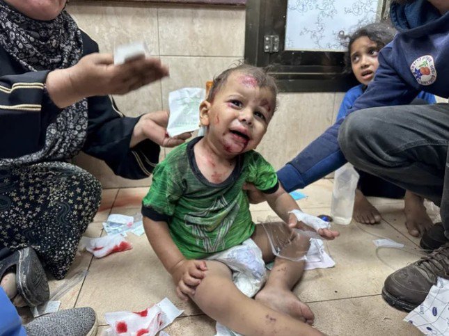 Một em bé Palestine bị thương được đưa vào bệnh viện Deir el-Balah, miền trung Dải Gaza, ngày 8/6. (Ảnh: Reuters)