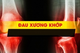 Tin tức sức khỏe - Cựu chiến binh già chiến thắng đau nhức xương khớp bằng “mẹo lạ” ở Phú Thọ!