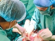 Sức khỏe đời sống - Hi hữu, 2 em bé chào đời cùng vòng tránh thai