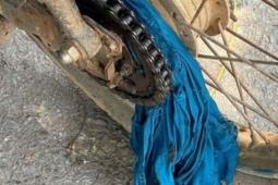 Người phụ nữ ở Quảng Ninh ngã gãy tay do sai lầm khi mặc áo chống nắng