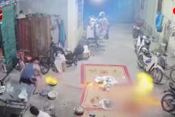 Media - Cách trị bỏng do nướng mực, cá bằng cồn