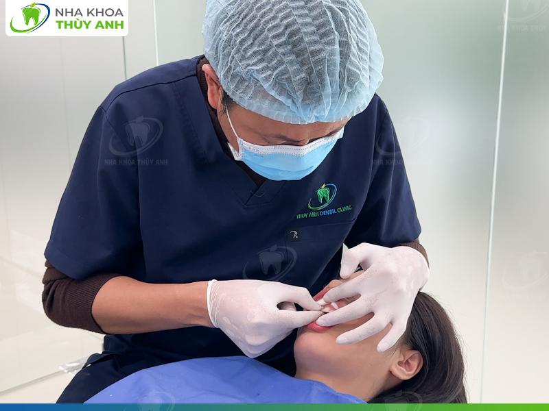 Bọc răng sứ thẩm mỹ đẹp tự nhiên, an toàn tại nha khoa Thùy Anh - 5